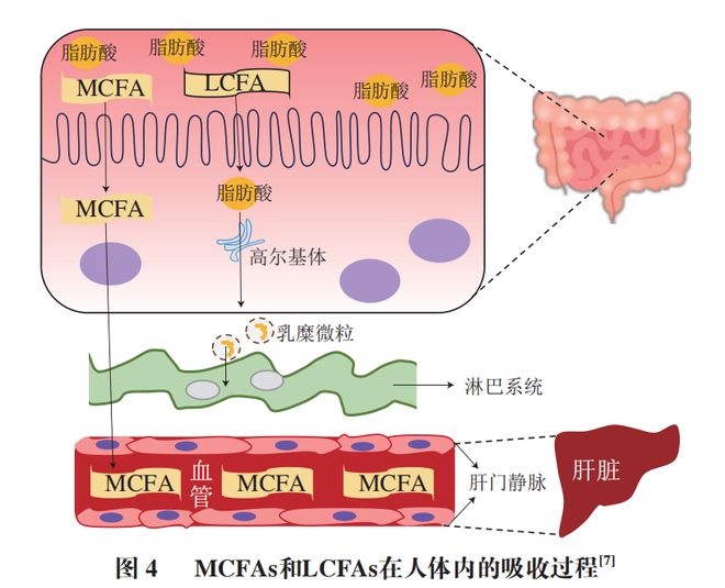 《食品科学》:中国农业大学肖卫华教授等:中链脂肪酸在疾病辅助治疗中的应用及作用机制研究进展(图3) 《食品科学》:中国农业大学肖卫华教授等:中链脂肪酸在疾病辅助治疗中的应用及作用机制研究进展(图3)